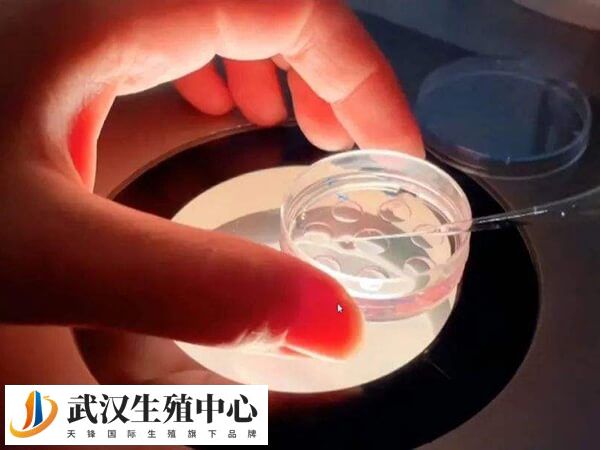 试管进入周期要做什么