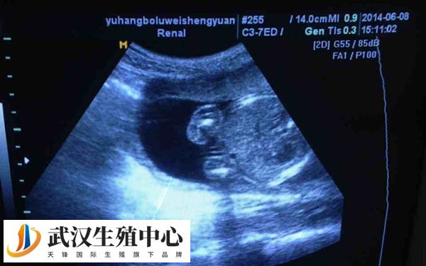 卵泡在4天内长1mm不正常