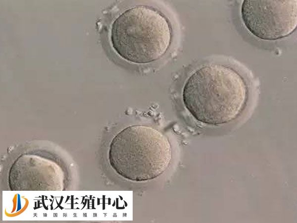 激素水平会影响卵泡发育