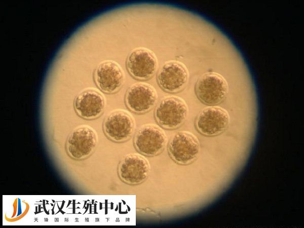 胚胎移植后可以食用上海青