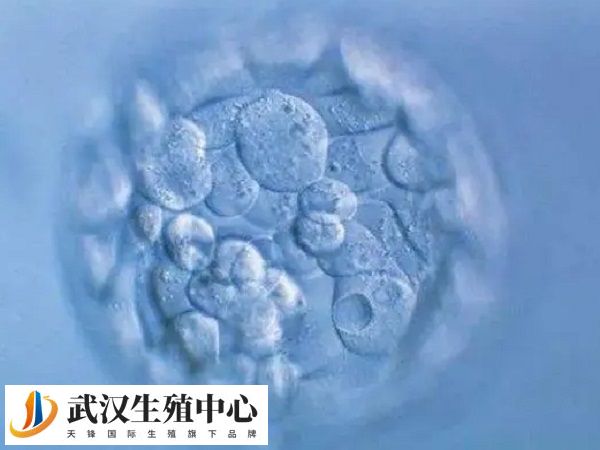胚胎碎片多与精卵质量有关