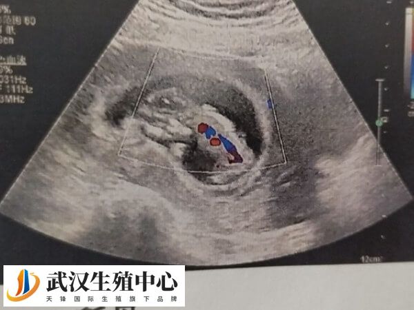 试管移植失败接下来怎么办