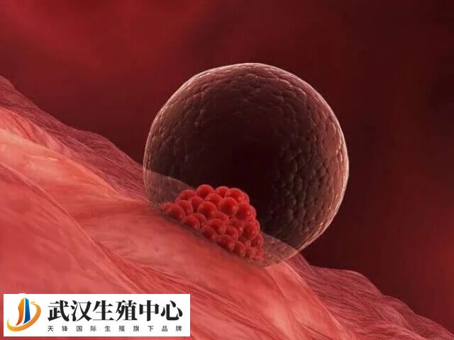 试管婴儿最重要的一步就是胚胎移植
