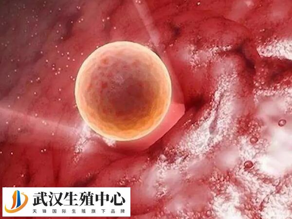 胚胎质量是着床效果的前提条件