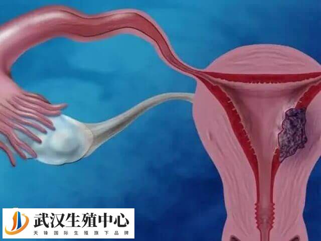 胚胎移植后有褐色血是不是已经生化了