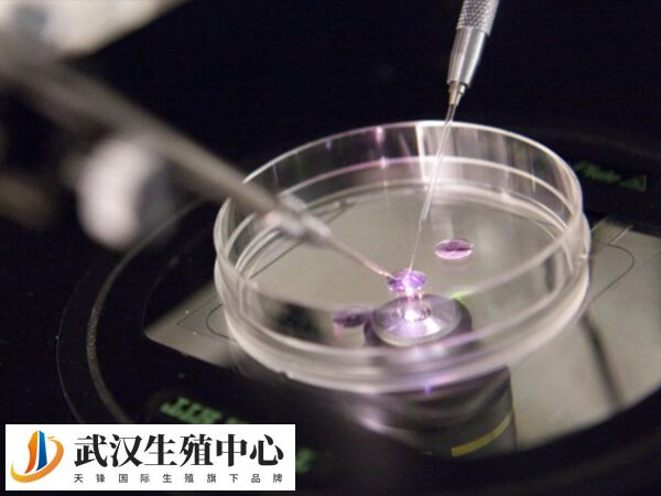 移植胚胎前要注意什么