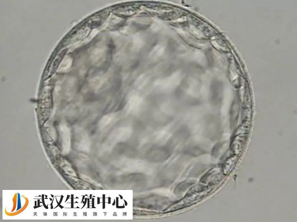 胚胎是否着床与其质量有关
