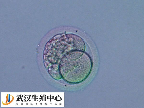 高质量的囊胚更容易成功着床