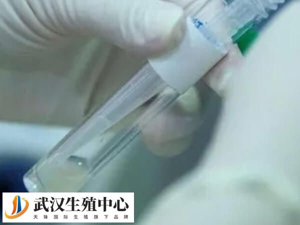国内禁止HIV阳性男性通过普通试管生育